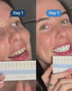 A SmilePro customer on day 1 and day 7 of the Advanced Whitening Kit, holding the shade guide.